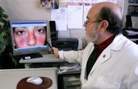 El diagnóstico precoz es "clave" para controlar la evolución del lupus 