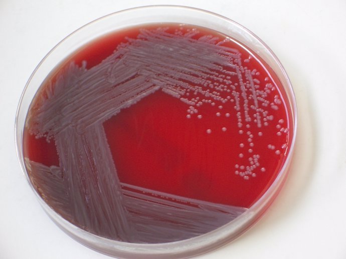 Bacteria Salmonella Enterica