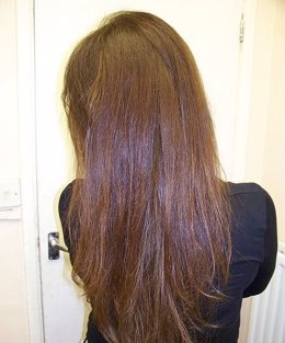 Pelo, Cabello, Calvicie.