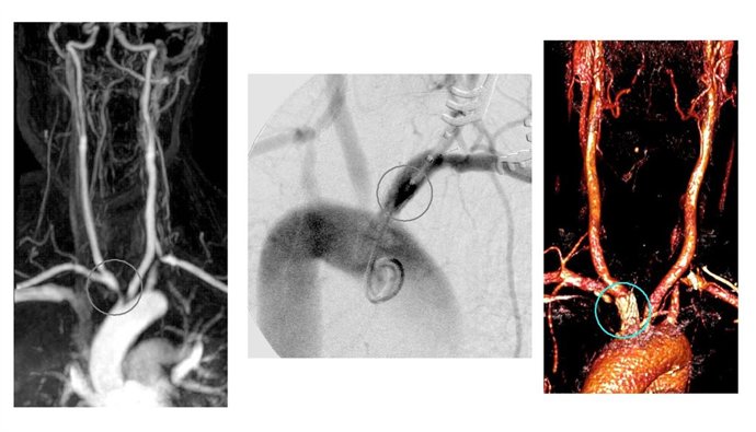 Imágenes De La Intervención En El Hospital Peset