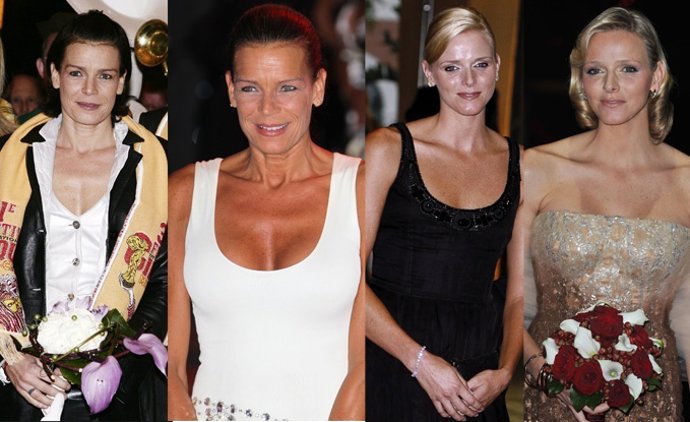 Montaje Estefania Y Charlene Operación De Pechos