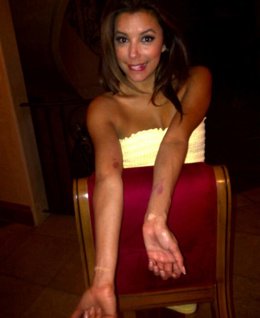 Eva Longoria Enseñando Sus Heridas De Guerra