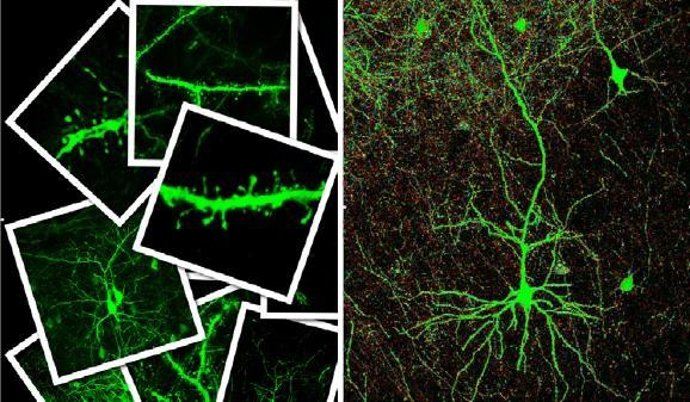 Conexiones neuronales