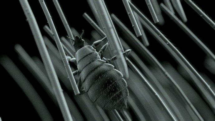 Piojo Pasando De Un Pelo A Otro