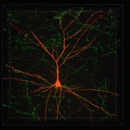 Neuronas