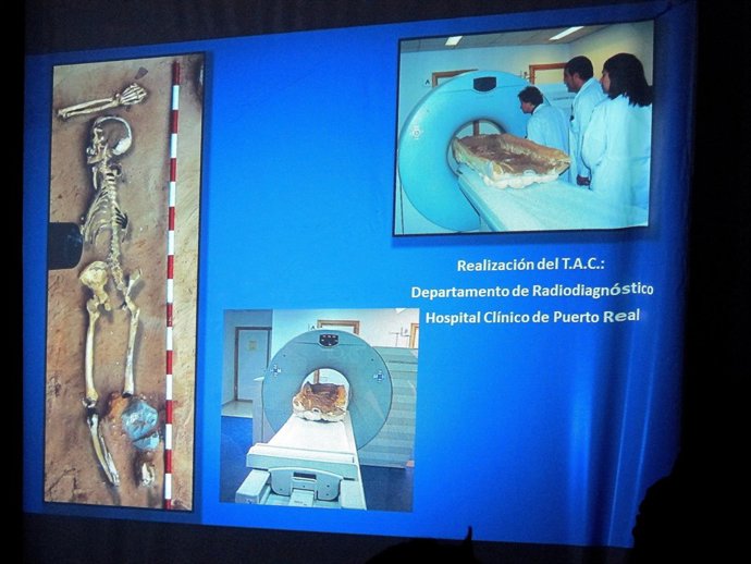 Esqueleto De Un Individuo Del Siglo VI A.C. Hallado En El Teatro Cómico De Cádiz