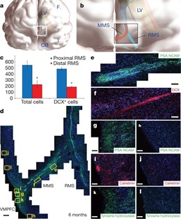 Descubierta Una Posible Causa De Trastornos Neuronales En Niños.
