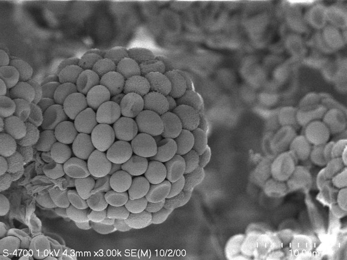 Hongo Trichoderma Asperellum, Microorganismo Que Reduce Enfermedades En Plantas