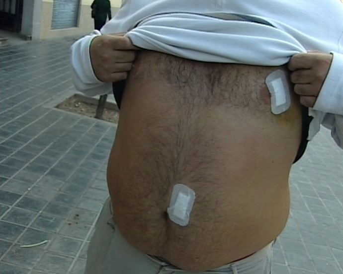 El Hombre Sufrió Heridas En Pecho Y Abdomen