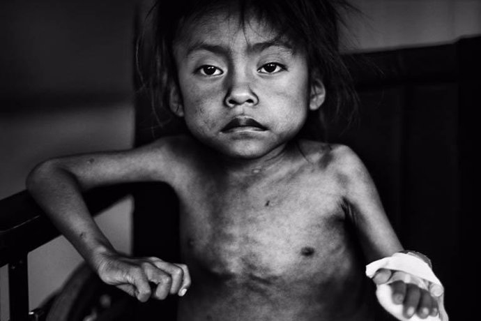 Segundo Premio Del Concurso De Fotografía De Unicef