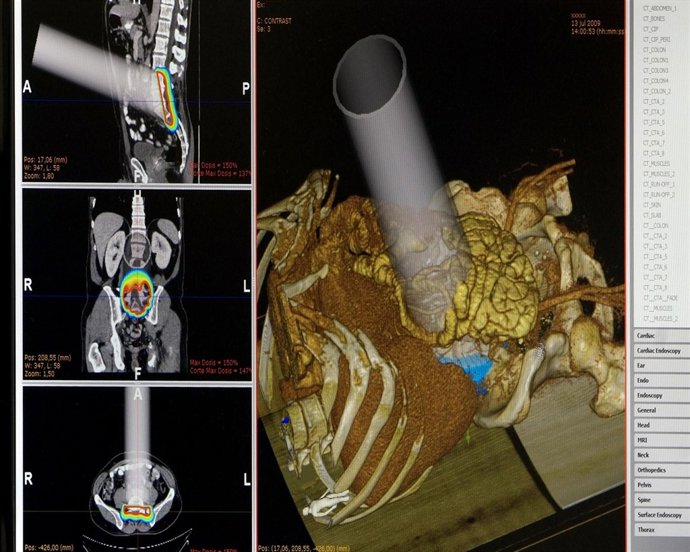Imagen Del Interior Del Cuerpo Humano Vía Simulador