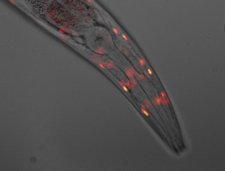 Imagen De Un C.Elegans
