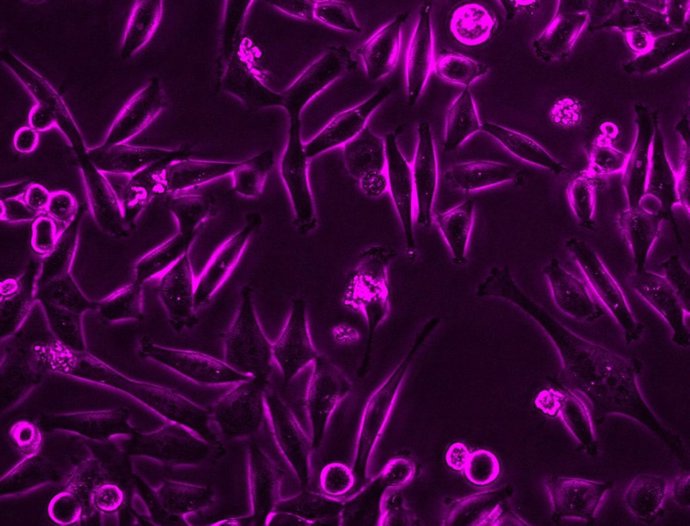 Exposición Danza Infinita, En Laboral