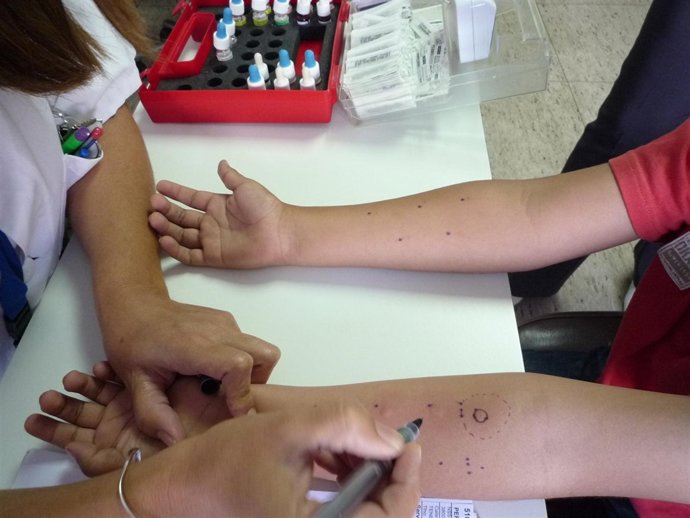 Prueba En El Servicio De Alergología