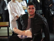 Ángel, El Gijonés Trasplantado De Antebrazo