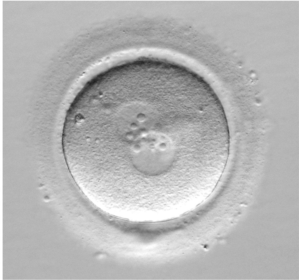Las mujeres fértiles tienen en sus ovarios células madre que podrían