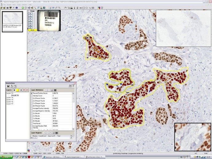 Proyecto Tradionp De Indra