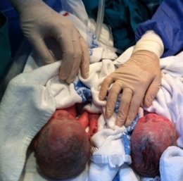 Gemelos recién nacidos