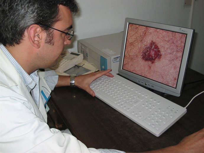 Un Médico Observa Un Melanoma Gracias A La Teledermatología