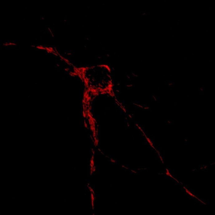 En Rojo, Localización De Mitocondrias En Una Neurona