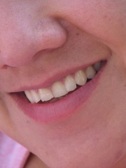Imagen de una sonrisa enseñando los dientes
