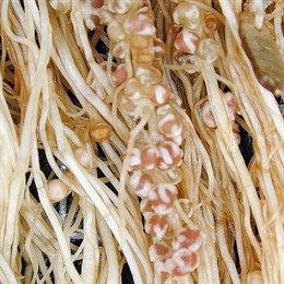 Nódulos Formados Por Las Raíces De La Alubia De La Bañeza