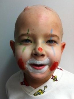 Ricard Garcia, Niño De Seis Años Enfermo De Cáncer