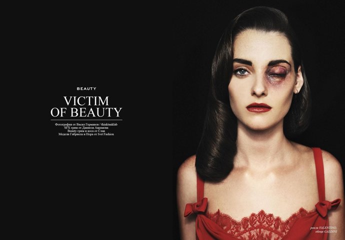 Victim of Beauty
