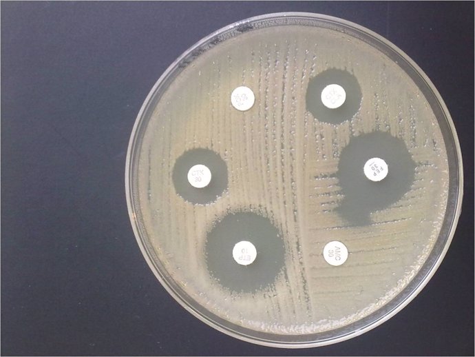 Antibiograma E coli resistencia a AMC