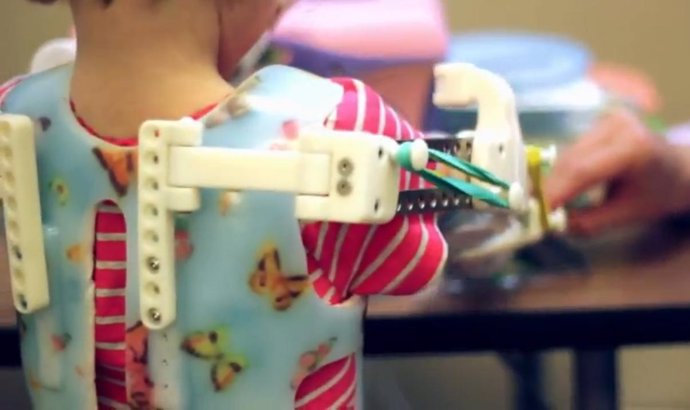 Exoesqueleto de niña de dos años de EEUU desarrollado a partir de impresora 3D