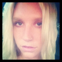 La cantante estadounidense Kesha