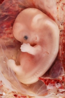 Embrión Humano De 9 Semanas