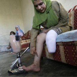 una mujer herida por bombas de racimo