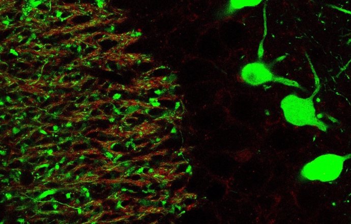 Neuronas Fluorescentes Del Cerebro De Los Ratones Objeto Del Estudio De La UV