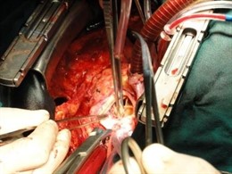 Gobierno de Extremadura