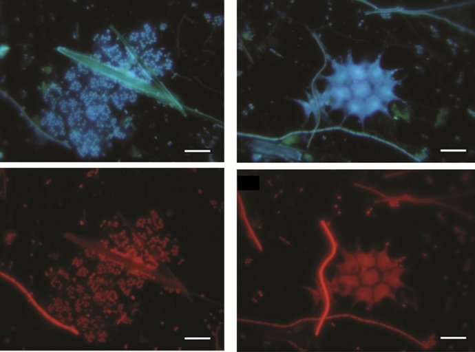 Microfotografías De Bacterias