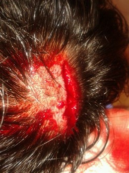 Un joven herido en la cabeza tras la manifestación en Palma