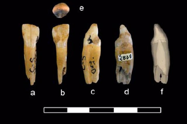 Diente de neandertal