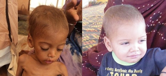 Habibi, antes de recibir ayuda y dos meses y medio después