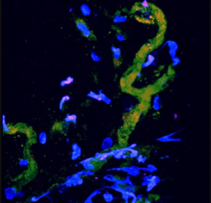 En amarillo, vasos sanguíneos de ratones regenerados con células madre humanas