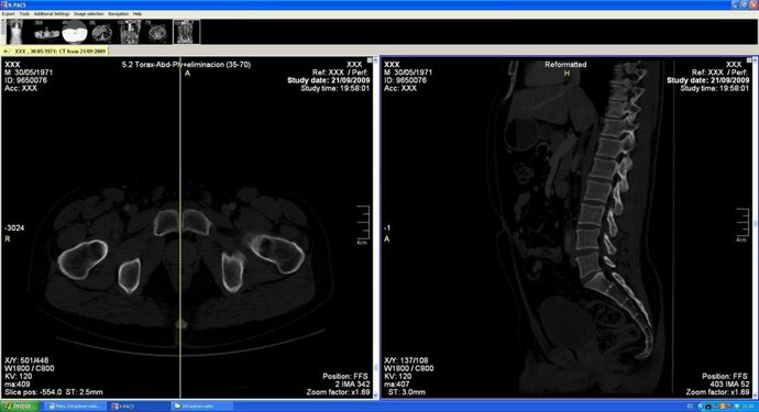 Ejemplo de selección del corte de estudio. 