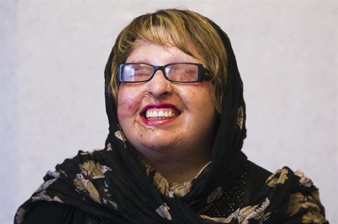 Ameneh Bahrami, Iraní Que Perdonó A Su Marido Por Dejarla Ciega