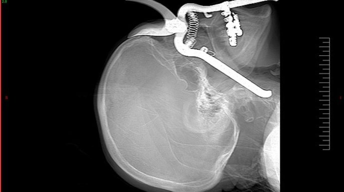 'Urgencias Punzantes'