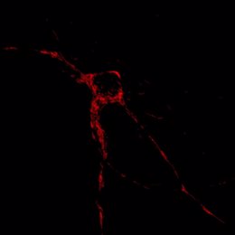 En Rojo, Localización De Mitocondrias En Una Neurona