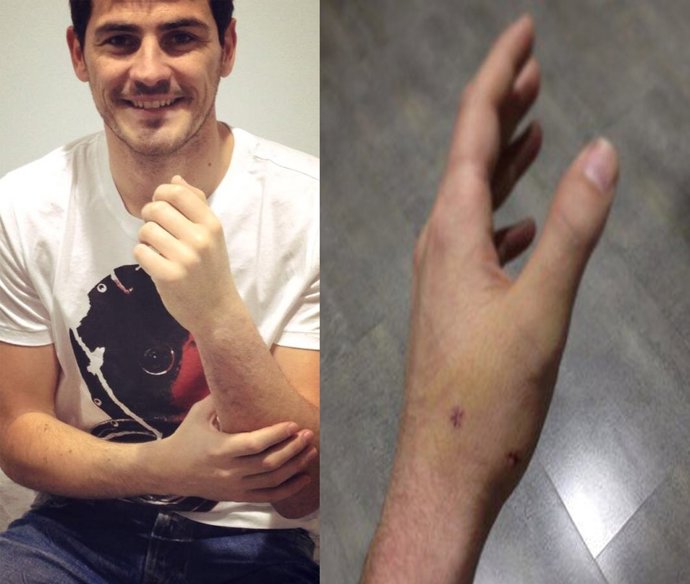 Iker Casillas sin escayola