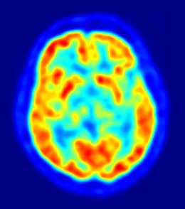 cerebro, recurso, neuronas