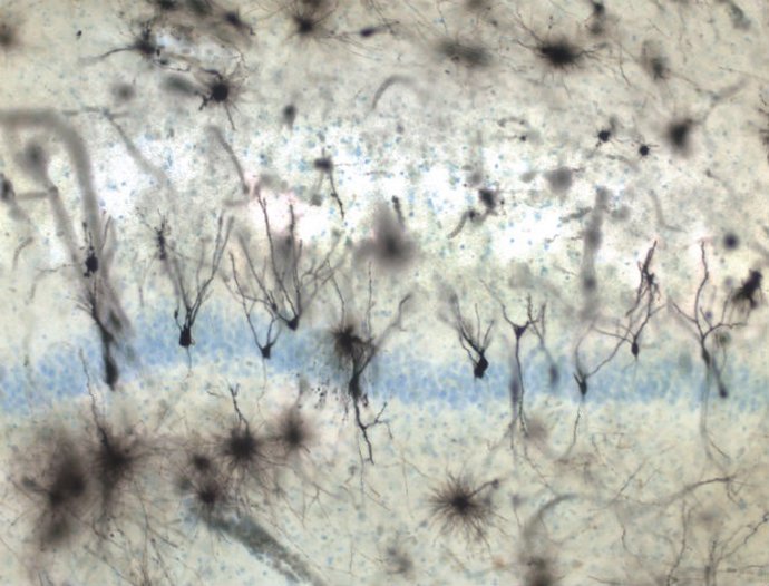 Neuronas granulares