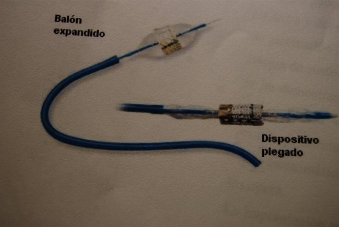 Dispositivo implantación transcatéter prótesis valvular aórtica