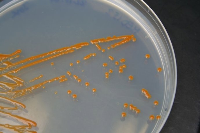 Cultivo de la bacteria