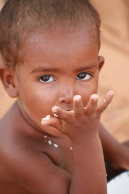 Desnutrición en Malí